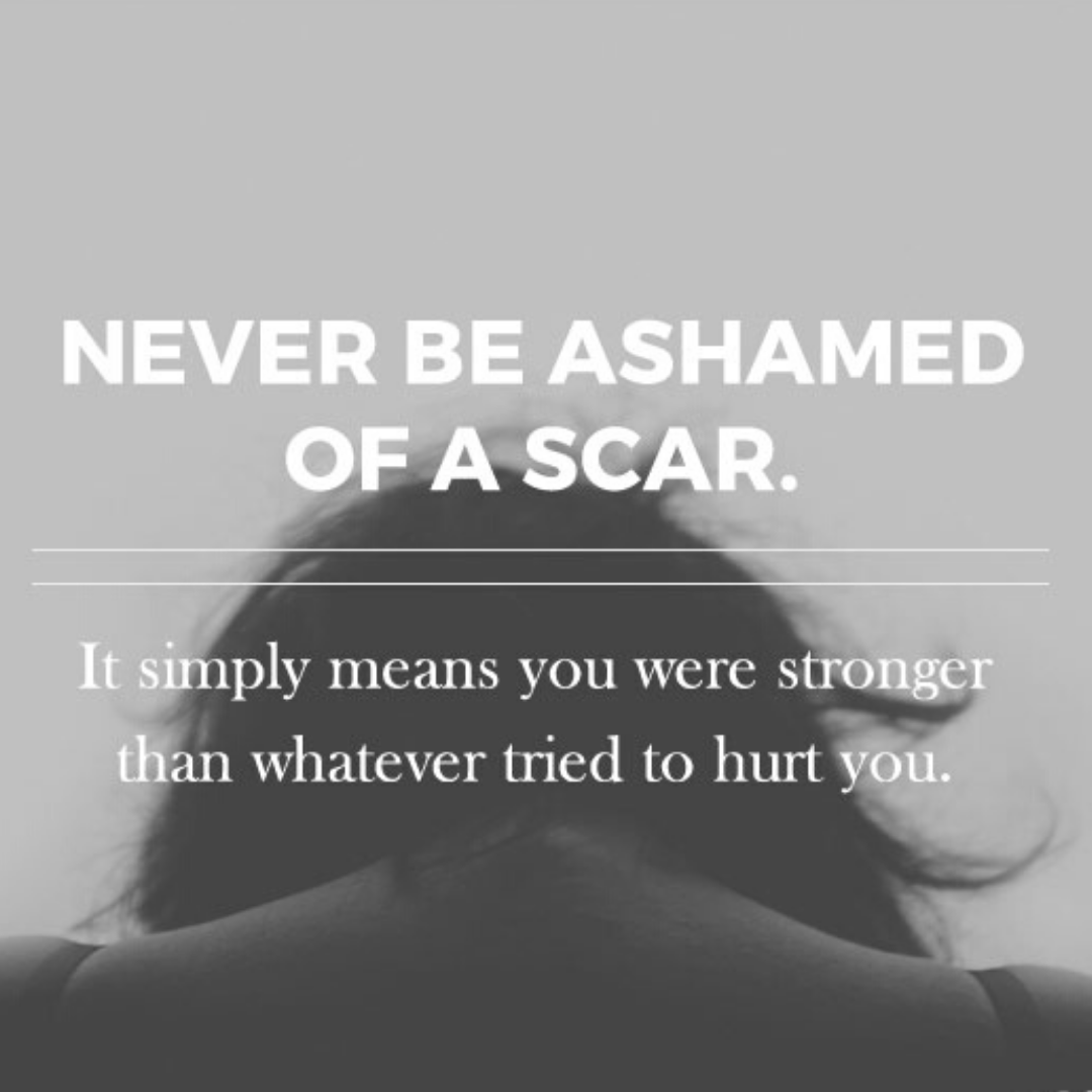 Tressesofcare's tweet photo. https://t.co/IpdcBkcLDE #charity #nonprofit #giveback #socialgood #volunteer #fundraising #change #dogood #community #support#causes#instagood#whoareyou#hairloss#chemotherapy#kidswithcancer#cancersucks#hairloss#godislove#jesusislove inspired #motivation#inspiration #goals https://t.co/483XGwSqjf