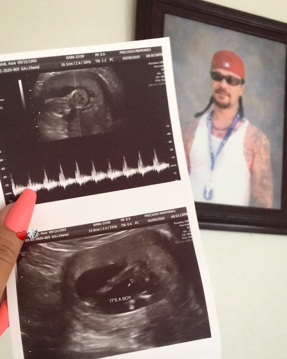 asiamiyagi_'s tweet photo. I knew he’d come back to us... I knew he loved us too much to leave us forever. Family &amp; friends; it’s a boy.♥️ #BabyDice2020 https://t.co/ZXDGI2RxB7