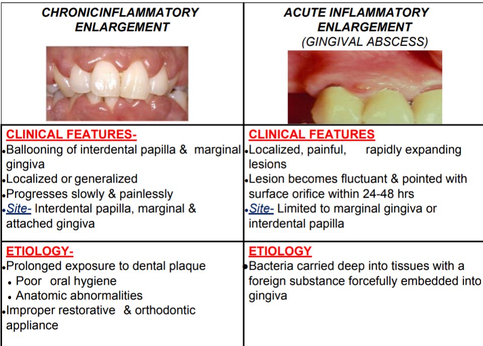 Gingival Enlargement #dental_by_hadeel - المسلسل من هديل 🕊 @Hadeel7m ...