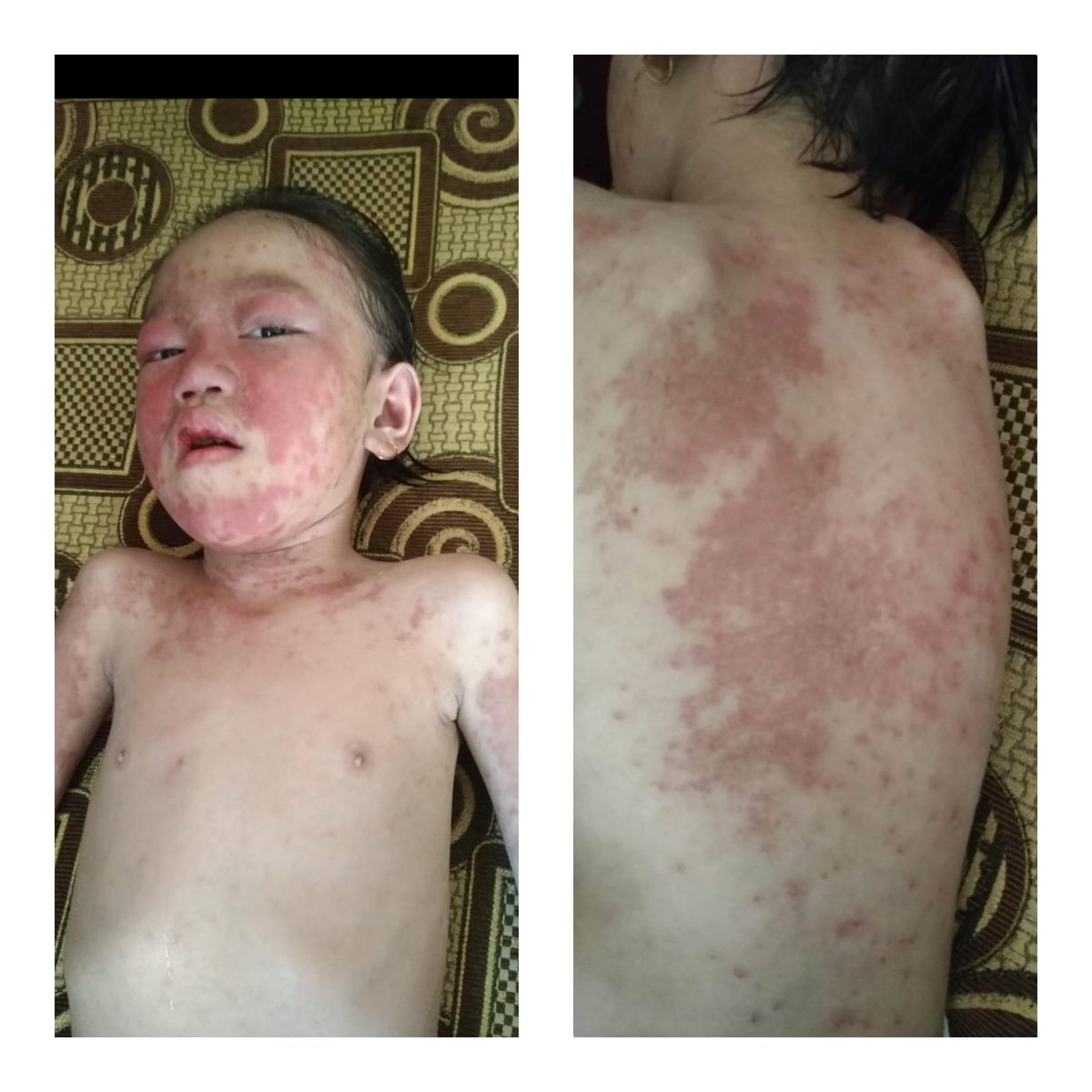 Hallo warga twitter, please do your magic

Teman teman sekalian kenalin ini ponakanku namanya devy, dia sakit lupus, lagi butuh banget donasi buat melanjutkan pengobatan ke surabaya