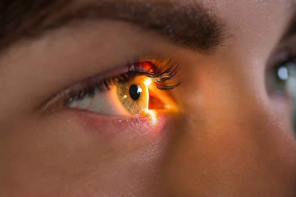 Descubre más sobre el glaucoma; causas, tratamientos y consecuencias bit.ly/2WdlnQf #Glaucoma #Oftalmologo #Monterrey