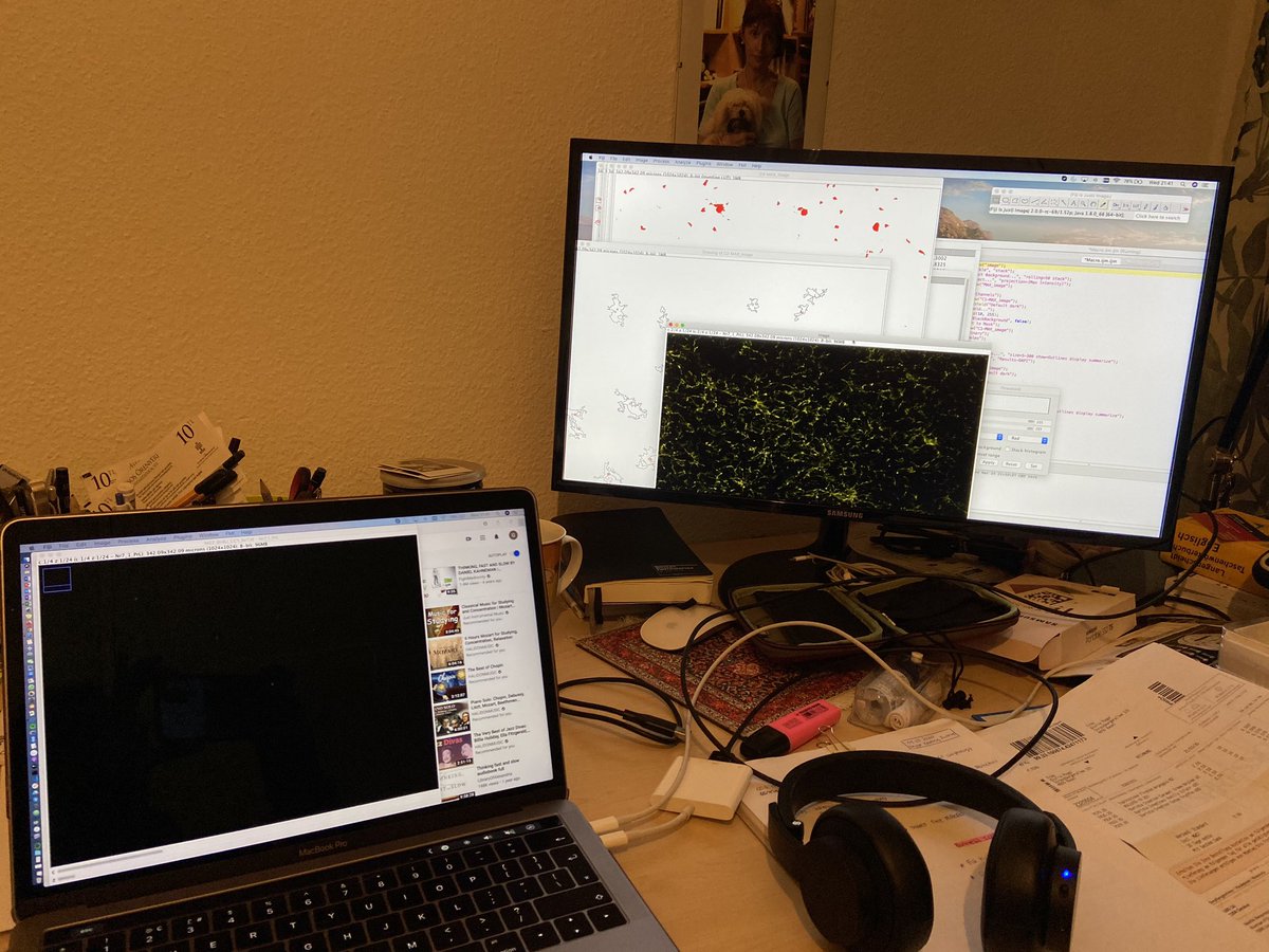 GiuliaPoggi86's tweet image. Finally, it seems that OLIGOs don’t mind to be automatically counted 🤩💻🏡! #stayathome #dosomecoding #myelin #oligodendrocyte ❤️