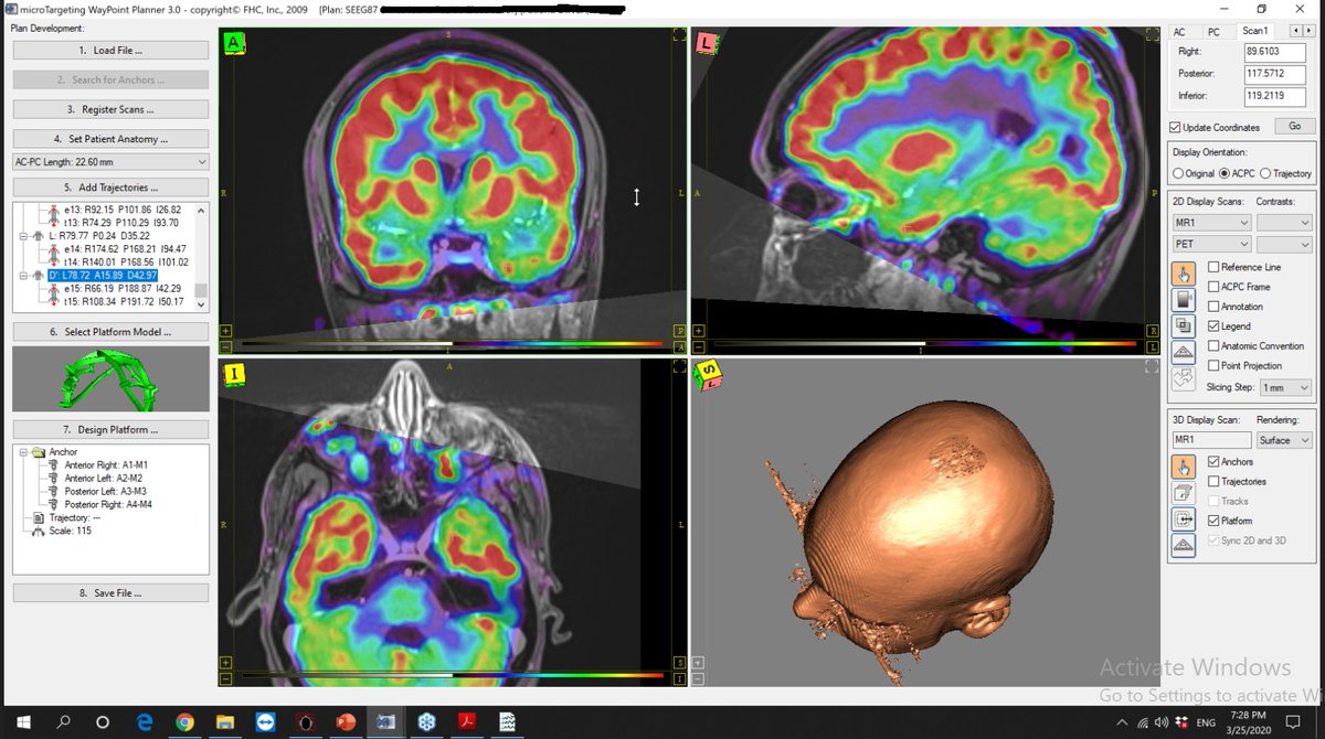 EpiCARE_ERN's tweet photo. Regular #surgical #epilepsy case discussion with three cases from Romania, Czech Republic and Catalonia.
We have 41 clinicians on the call. #ShareCareCure - #econsultancy at its best 🧠💻👩⚕️ https://t.co/YqqnCfqH9I