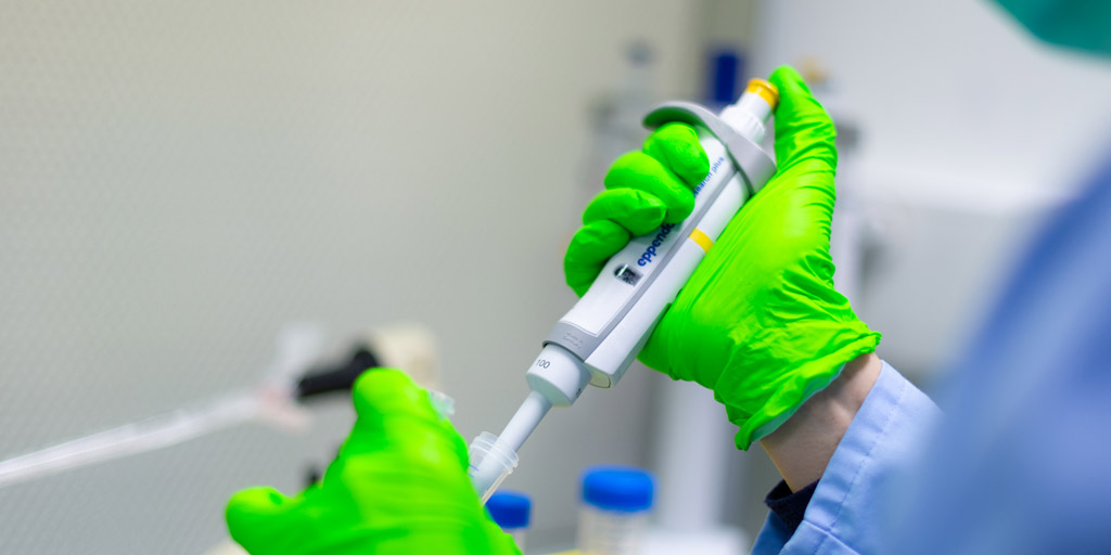 univbordeaux's tweet photo. Face à l’épidémie de #COVID2019 , la recherche se mobilise dans le monde pour lutter contre le #coronavirus. Plusieurs équipes de recherche de @univbordeaux @CNRSAquitaine @Inserm @BordeauxINP @CHUBordeaux sont également impliquées.

https://t.co/seRmldYLVZ

📷@gdphotosbdx https://t.co/umbwRsi4Cw