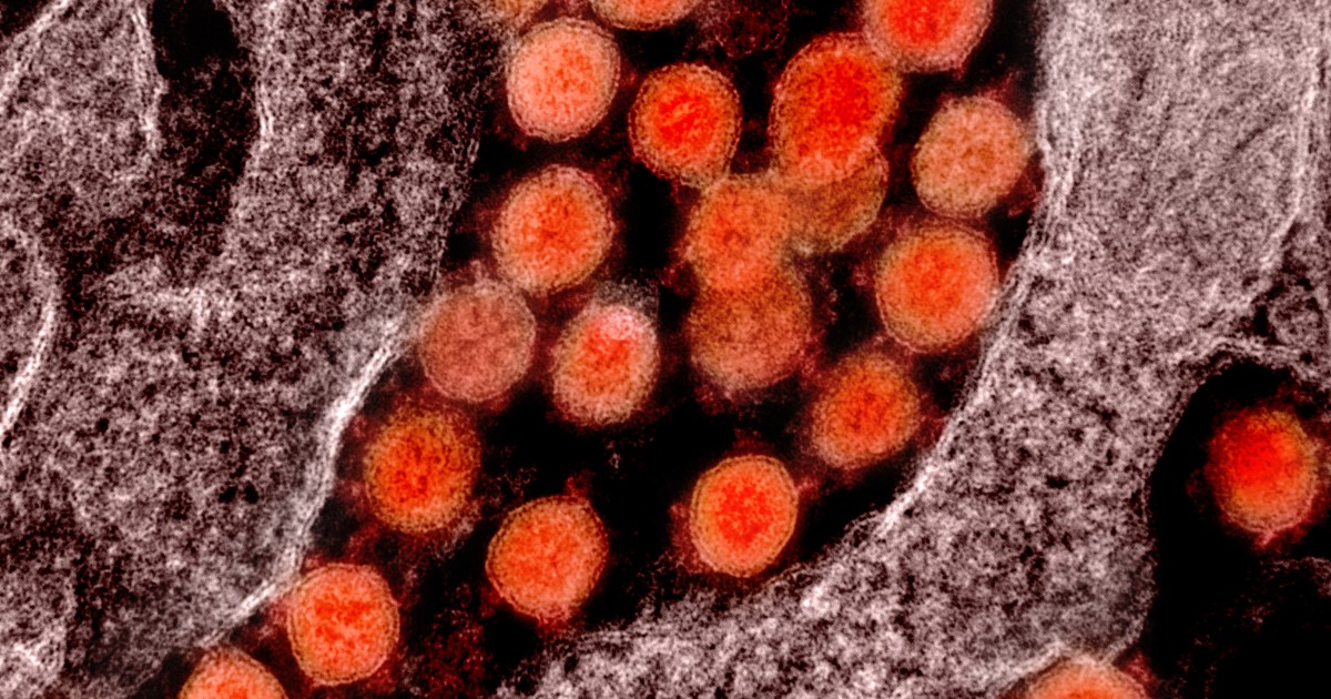 San Diego's Mesa Biotech gets approval for 30-minute coronavirus test dlvr.it/RSYdVx