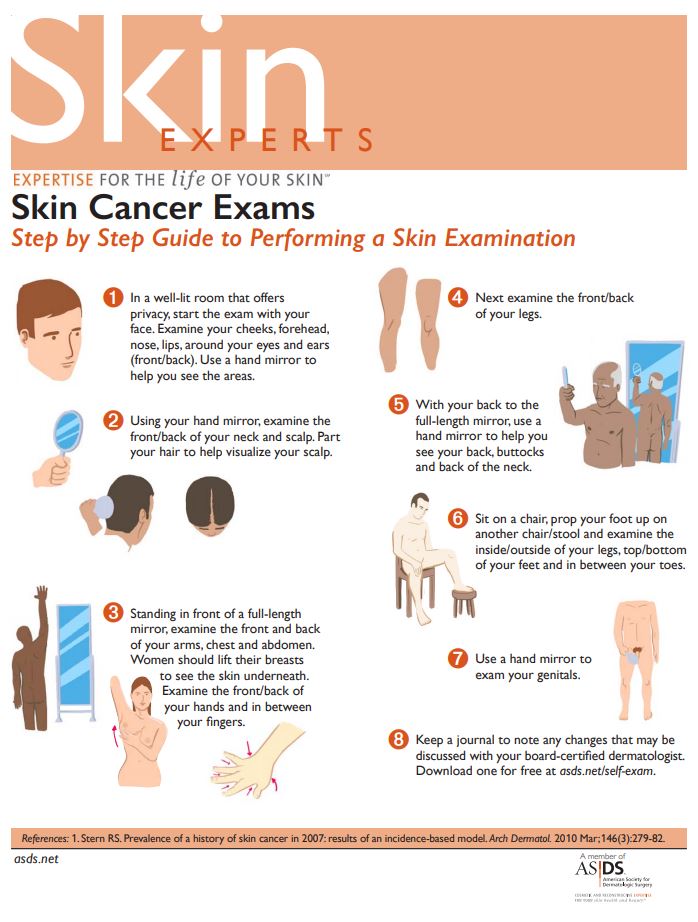 One of the top 10 ways to prevent skin cancer is to check for moles regularly, especially if there is a history of #skincancer in your family. Learn more on how to perform a self-exam at asds.net/self-exam-kit #ASDSSkinMD