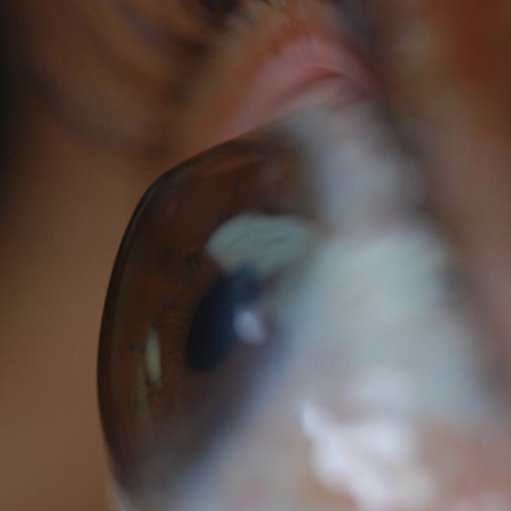 ModOptometry's tweet photo. Dr. Charles Roseman discusses identifying and managing corneal ectasia through pre-op and post-op screenings in CollaborativeEYE section of MOD: https://t.co/Cb29c7xm7b @HelpMyDryEyes @JSchweitzerOD #optometry #optometrist #eyecare #cornealectasia #imaging #CXL #collaborativeeye https://t.co/hWdmjemYVD