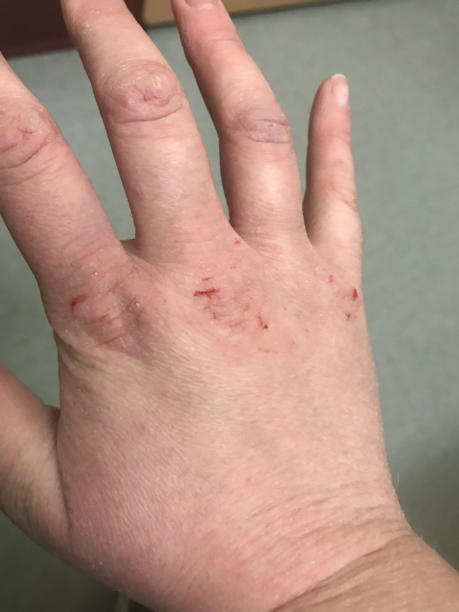 ZeldaTheRuler's tweet image. //anyone wanna trade hands?