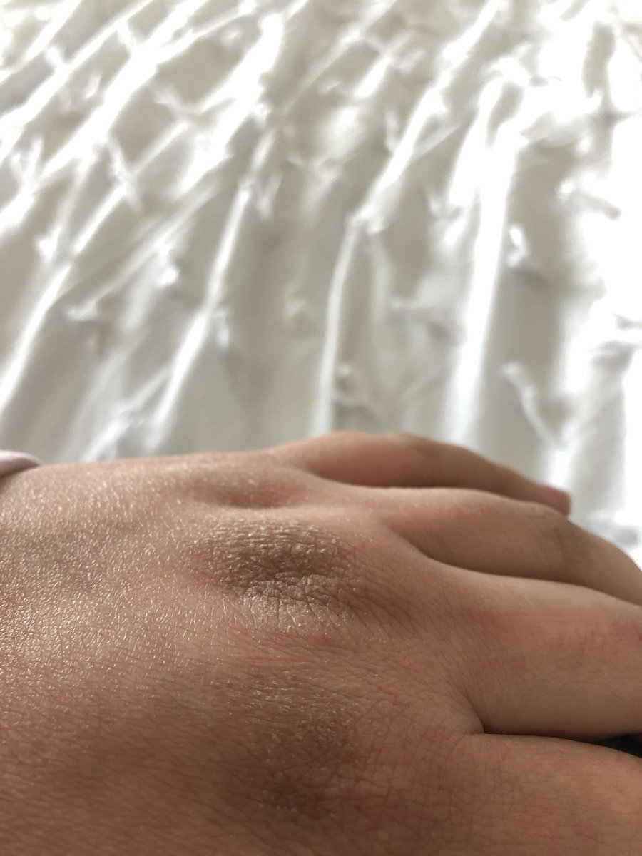 RPishtek's tweet photo. Well, I’m definitely washing my hands! https://t.co/Dr3dnnUWu1