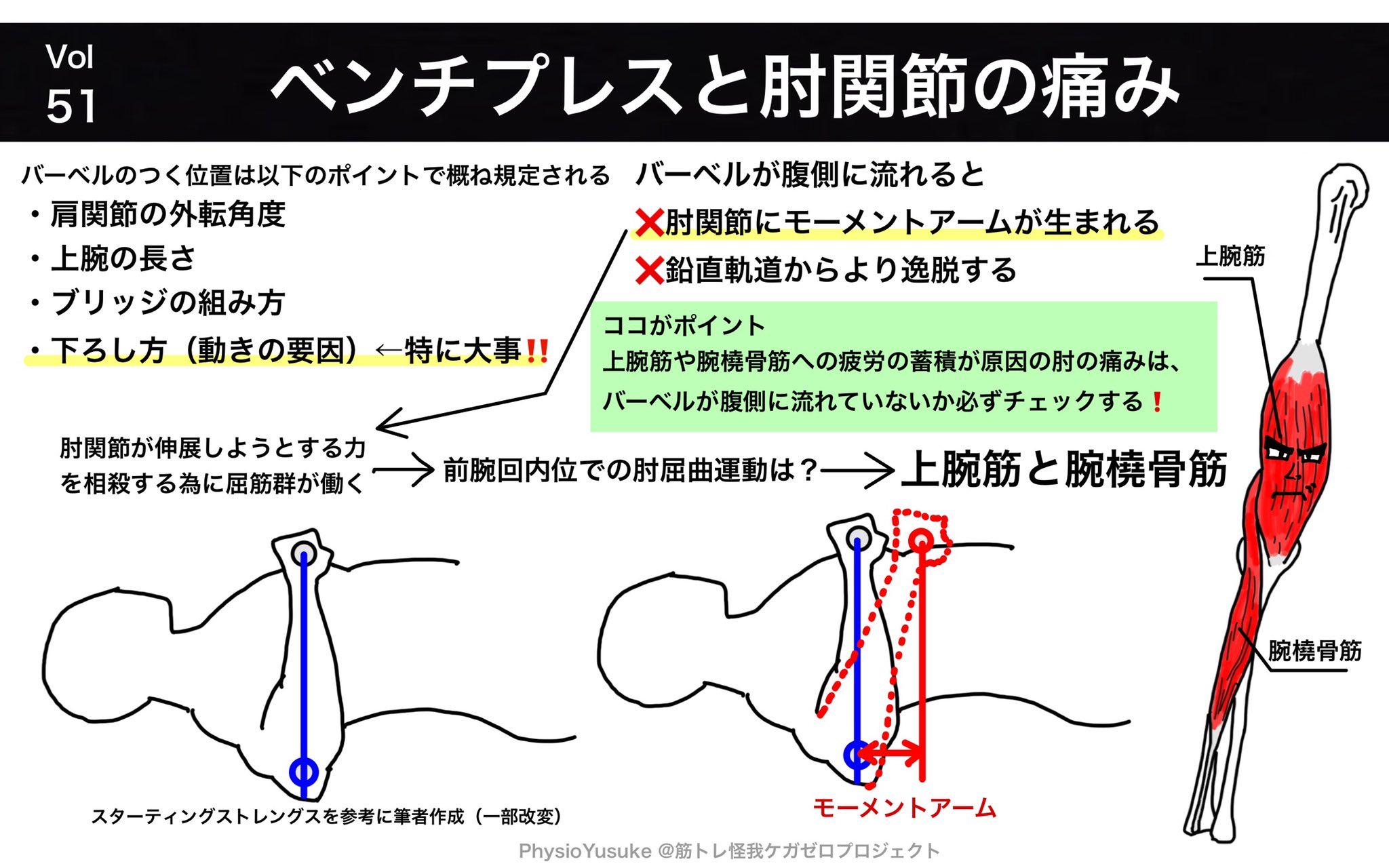 Uzivatel ユウスケ 筋トレ怪我ケガゼロプロジェクト Na Twitteru 復習ノート ベンチプレスと肘関節の痛み 繰り返す肘の痛みは フォームを見直す機会です ポイントは3つ 前腕の角度は垂直か 脇の開きは適切か ブリッジは組めて