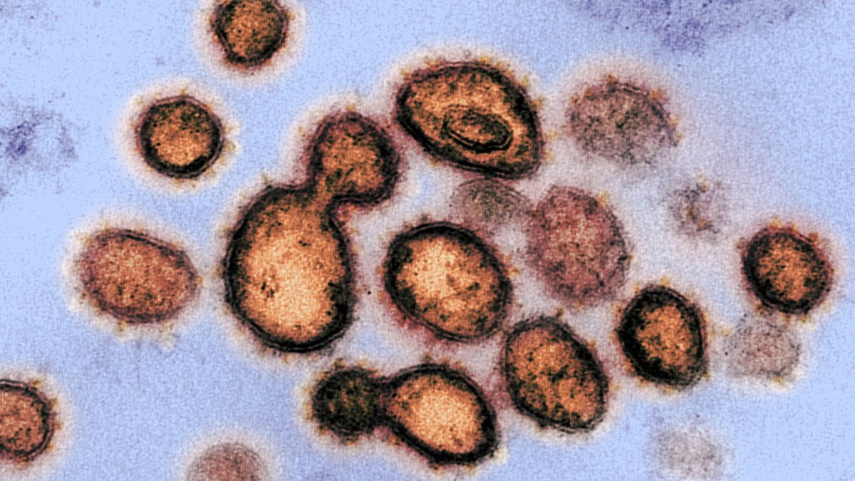jpsuseelam's tweet photo. WHO launches global mega trial of the four most promising corona virus treatments

https://t.co/bctoTgmfrZ https://t.co/SubFmDjgkj