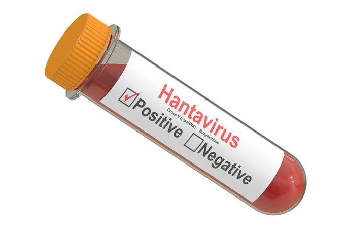 WhiteRabbit111's tweet photo. World hasn't even recovered with Chinese Corona Virus ‘n China is already infected with another virus - #HantaVirus which is caused by consuming rats. Looks like China has decided to end the world, all by themselves 🧐

 #COVID19 #JantaCurfew #CoronaPandemic #MumbaiLockdown https://t.co/MEem9VAEHh