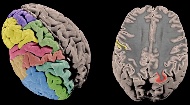 SpacioSanitario's tweet image. Investigación de @CIBER_SAM sobre arquitectura genética de la #cortezacerebral humana - actasanitaria.com/halladas-varia…