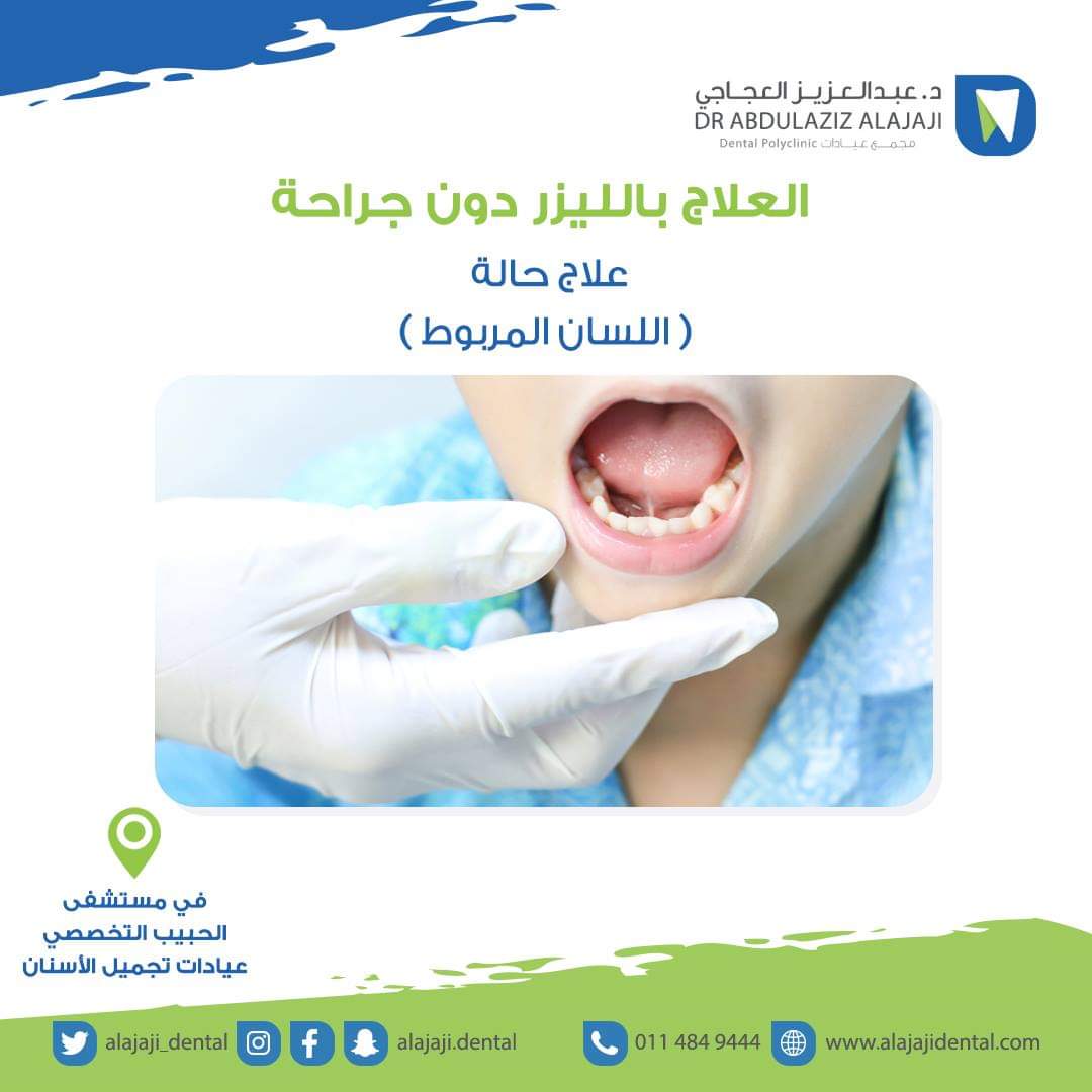 ALAJAJI_DENTAL's tweet photo. العلاج بالليزر دون جراحة
#عيادات_د_عبدالعزيز_العجاجي #اسنان_الأطفال #عيادة_الأسنان #تجميل_الأسنان #اسنان #ابتسامة #تنظيف_الاسنان #الرياض #الخبر #صحة_الاسنان #اللسان_المربوط
#dentistry #teeth #smile #cleaningteeth https://t.co/cxOJVOcuLQ