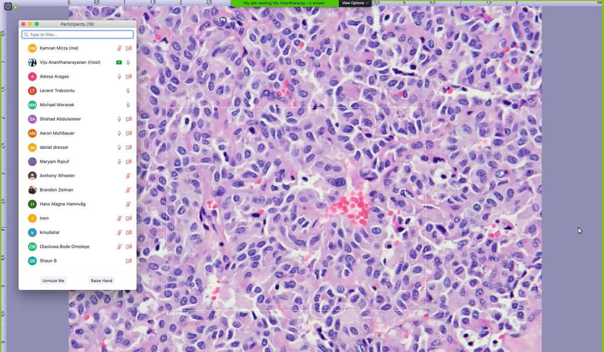 The amazing <a href="/loyolapathology/">Loyola Pathology & Laboratory Medicine</a> PD <a href="/Vijuananthan/">Vananthan</a> runs her #ShowAndTell session with our fantastic pathology #residents - #SocialDistancing is not #SocialIsolation - #MedEd continues!!