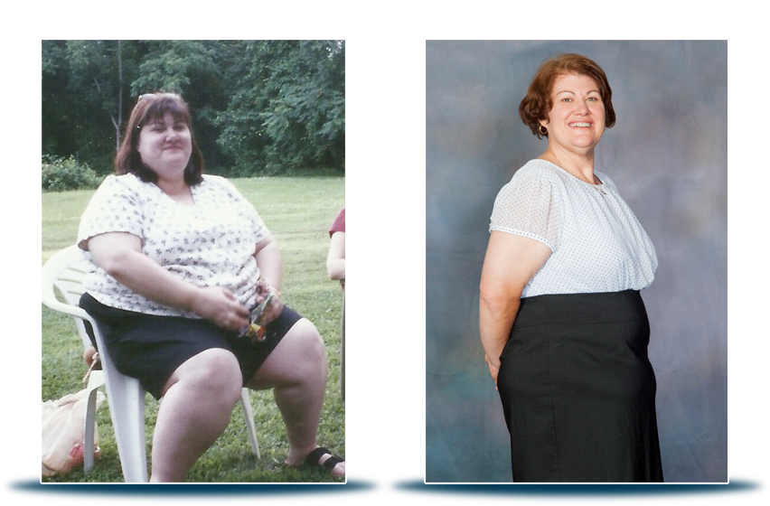 CCSbariatrics's tweet photo. “I didn’t want to live like that.” That’s often the epiphany for many of our patients who decide to undergo bariatric surgery. Bariatric surgery is much more than just a weight-loss method, it’s a surgery that can help turn your health and life around.
https://t.co/92IuQm7cKU https://t.co/xHpKd0tjit