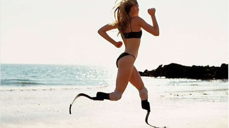 Excellent Ted Talk by Aimee Mullins - an American athlete, actress, model and advocate for women, sports and the next generation of prosthetics. 
.
.
ted.com/talks/aimee_mu…