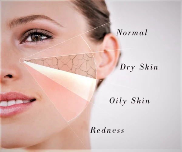 agingblissfully's tweet photo. Do you really know your #skintype? Knowing your true #skin type can help the next time you’re in the #cosmetics aisle. In fact, using the wrong products — or even popularized Internet hacks — for your skin type could worsen acne, dryness, or other skin problems.
#skinhealth https://t.co/HuylMiUIA1