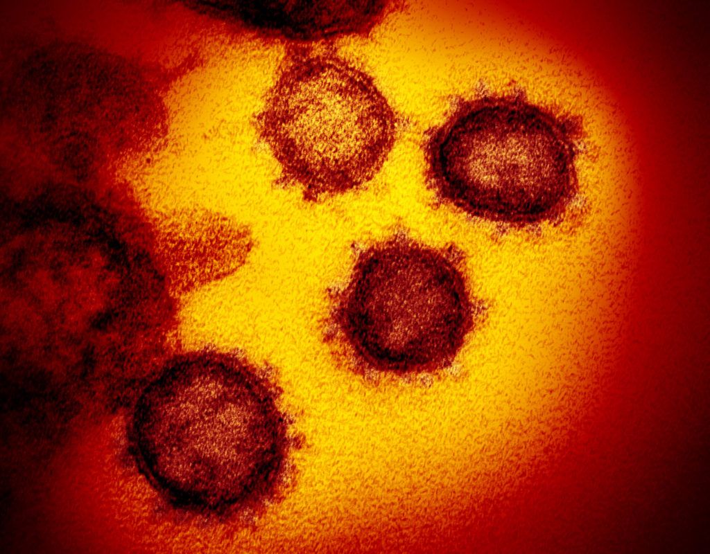 BongeneSearch's tweet photo. Catching up to #Coronavirus: Top 60 treatments in development: https://t.co/j2ZvFI4FIN #Covid19 https://t.co/XNq5J6dqdK