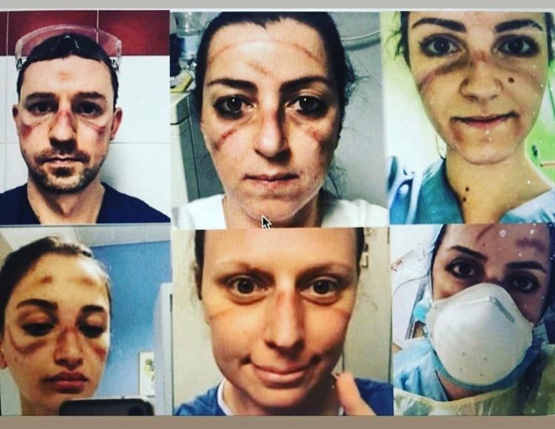 teachergoals's tweet photo. The exhausted faces of doctors on the front line of the coronavirus outbreak in Italy. #heroes 🧡 https://t.co/sBzs0izaSt
