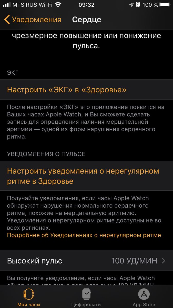 dimarus's tweet image. Хорошие предпосылки для России, может следющий апдейт принесёт таки ЭКГ
#AppleWatch #Apple #ios134 #ECG