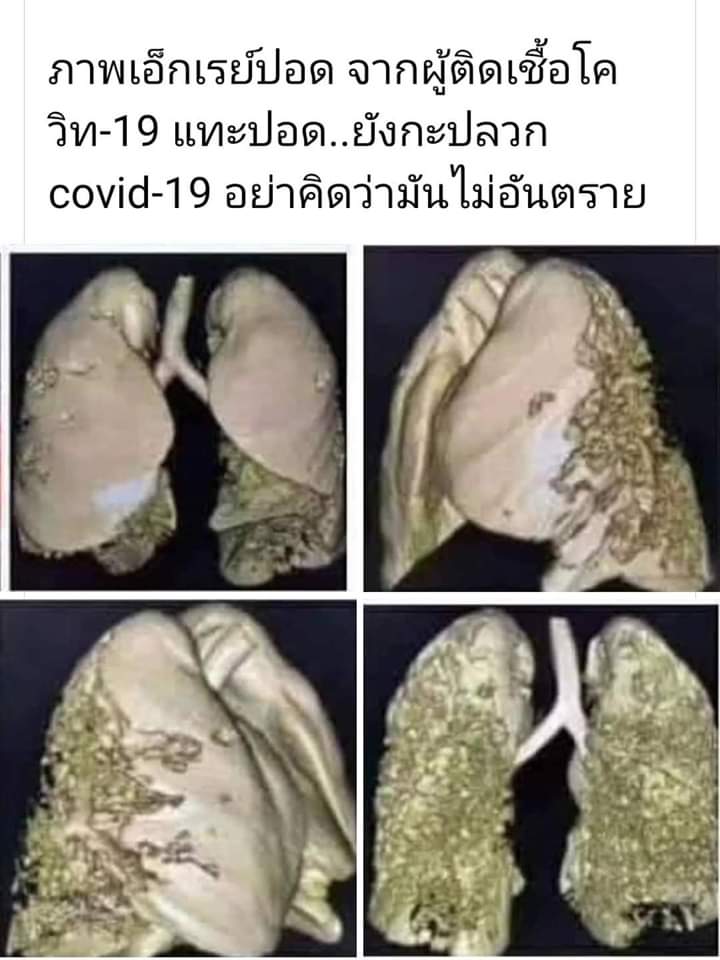 Rantida4's tweet photo. #โกวิท20ชนะโควิด19 #กสพท63 #COVID19 #เพื่อฮีโร่ไทยสู้โควิด19 #covid19thaiheroes #ให้เลือดฝ่าวิกฤติCOVID19 https://t.co/BXeVD2lGka
