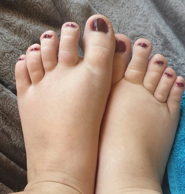 1 pic. Et voici mon petit 43 fillette. 

#pieds #feet #bbwfeet #camgirl #tds #Feetfettish #feetpictures