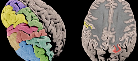 Biotech_Spain's tweet image. 📲 Avanzan en el conocimiento de la arquitectura genética de la corteza cerebral humana
📌 @CIBER_SAM 
👉🏻 ow.ly/H5PL30qszaR 
#genética #CortezaCerebral #EnfermedadesMentales