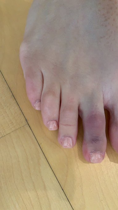 Who&rsquo;s going to nurse me better ? And guess what I cant get pain relief 💔😞 https://t.co/RLHjpQsUdN<a href="/tag/saudi"class="tags"><span>#saudi</span></a><a href="/tag/joshuaruiz2"class="tags"><span>#joshuaruiz2</span></a><a href="/tag/matchroomboxing"class="tags"><span>#matchroomboxing</span></a>