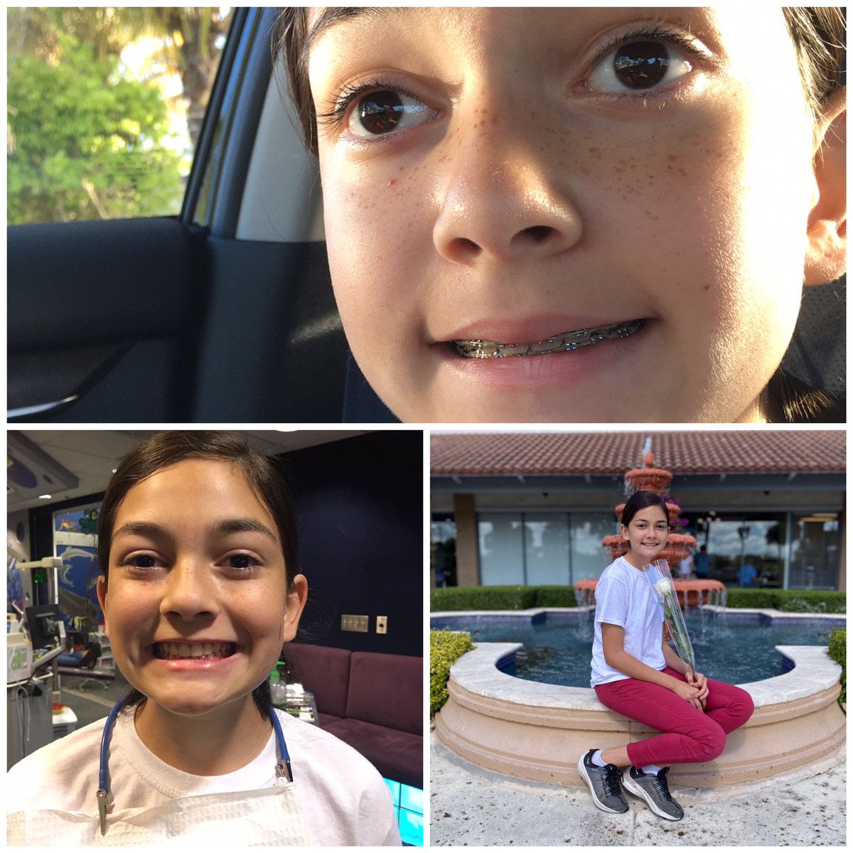 itsKathleenAli's tweet image. Somebody just got their braces off 😬hooray!  #TheyGrowSoFast