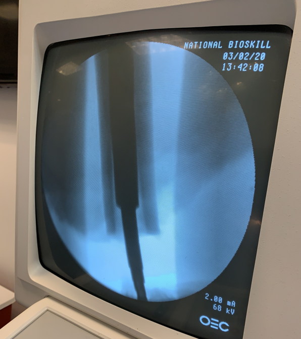 OnkosSurgical's tweet photo. Providing first-of-its-kind training is a must for advancing the treatment of musculoskeletal cancer and complex revision. Our lab last week in Pittsburgh, PA was a major step forward! #orthopedics #orthopediconcology #onkos  #osseointegration #startup #innovation #limbsalvage https://t.co/iNuDaxsgfM