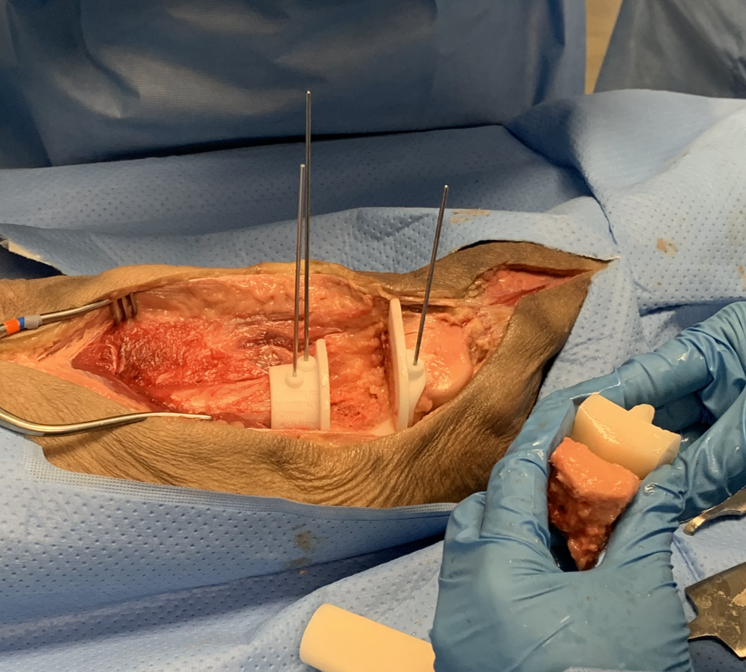 OnkosSurgical's tweet photo. Providing first-of-its-kind training is a must for advancing the treatment of musculoskeletal cancer and complex revision. Our lab last week in Pittsburgh, PA was a major step forward! #orthopedics #orthopediconcology #onkos  #osseointegration #startup #innovation #limbsalvage https://t.co/iNuDaxsgfM