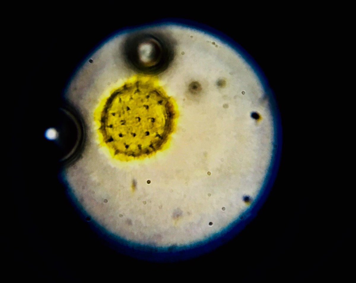 ZerOne65715876's tweet photo. It’s not #coronavirus just a #pollengrain under #microscope spotted in #Turkishhoney from #AyderYaylasi #honeyisyummy other things in views are dust&amp;gas bubbles😁 https://t.co/KH0Ps2JX1d