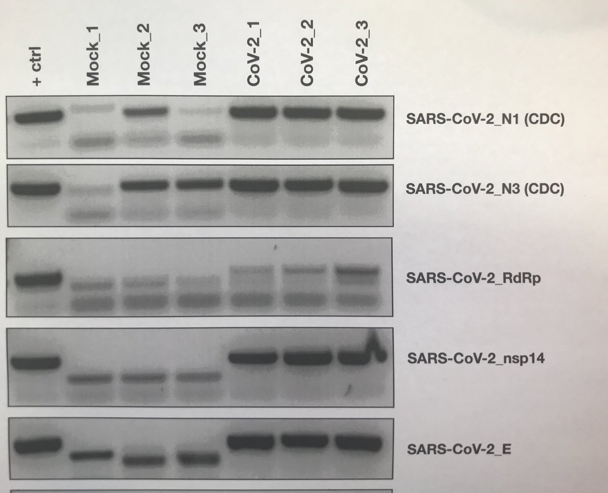 Additional proof that the CDC primers for #SARSCoV2 have a lot of background. Science done by ⁦<a href="/BenjaminNilsson/">Benjamin Nilsson-Payant</a>⁩