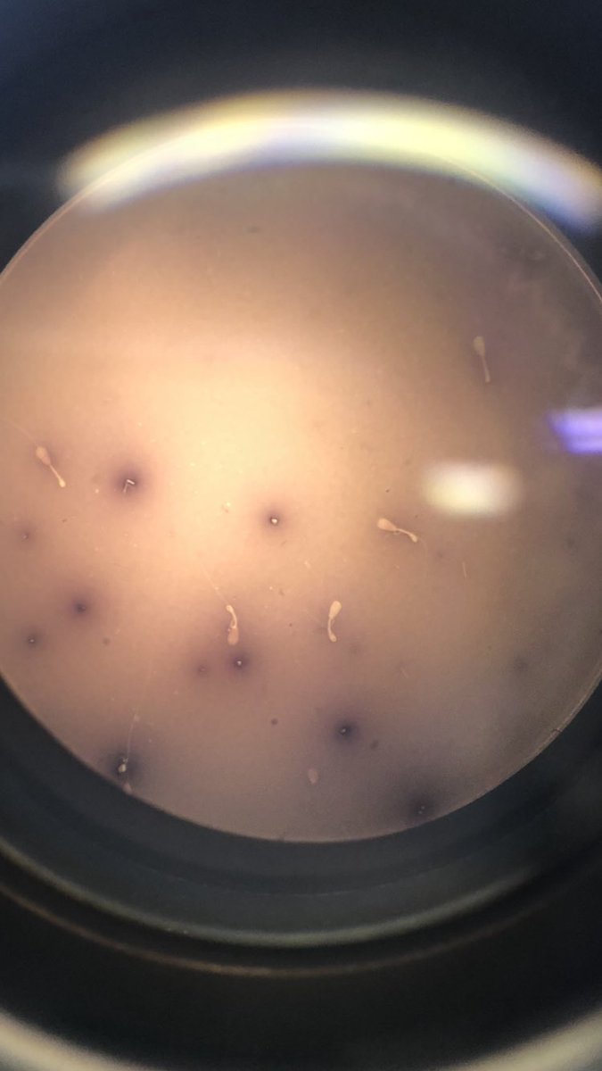 Ella_farm_vet's tweet photo. Please get your bulls #fertilitytested every year. Your tight 9 week bulling period is dependent upon it!
This week I failed yet another bull who has been used with good results over the last two years.
Photos shows the morphological examination - rubbish ! @DroveFarmVets https://t.co/y5u5r5Lbam