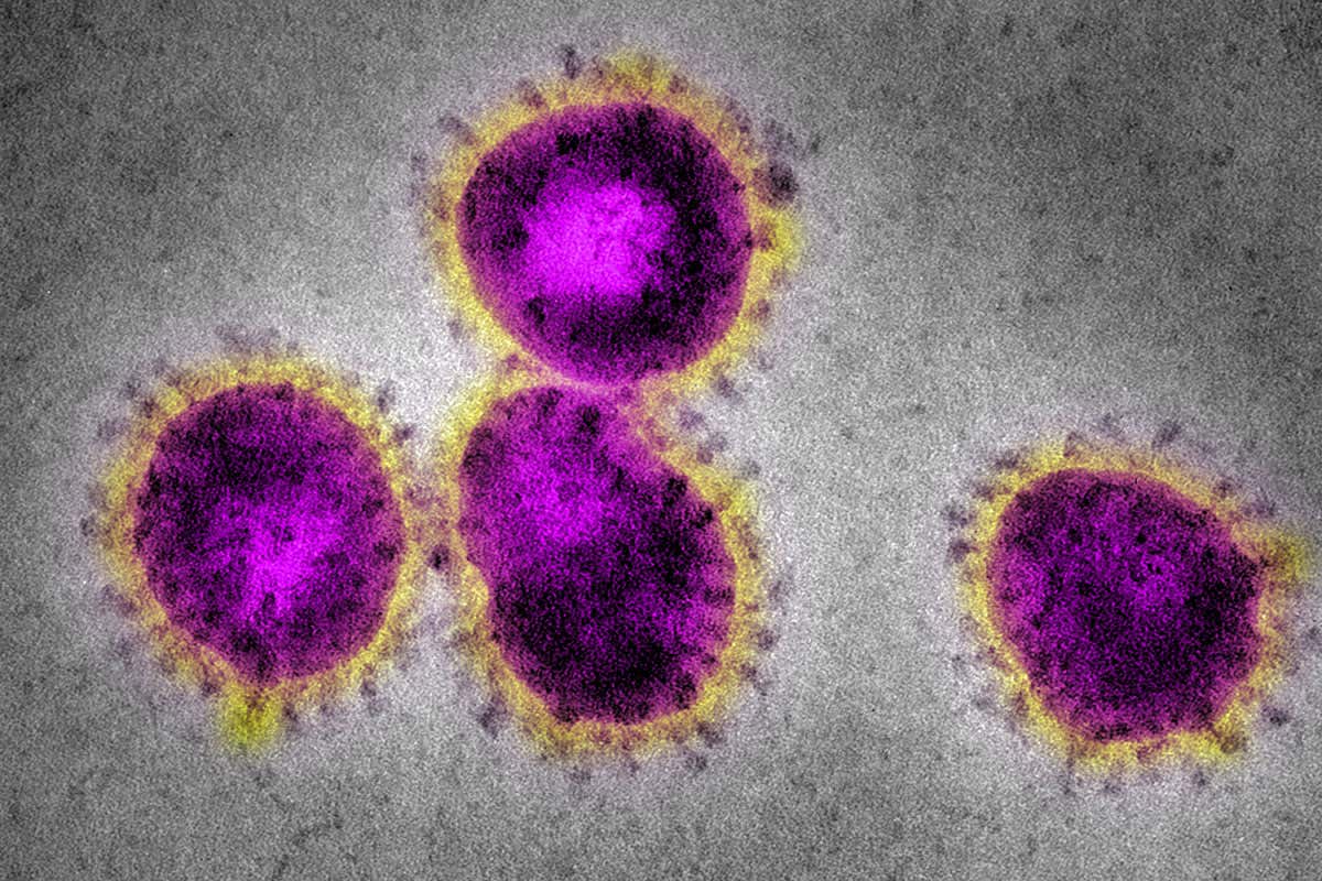 Cases in the republic of ireland up to 90 a percentage increase of 28.57% today #Covid_19 #CoronaOutbreak #Coronavirusireland #selfisolating