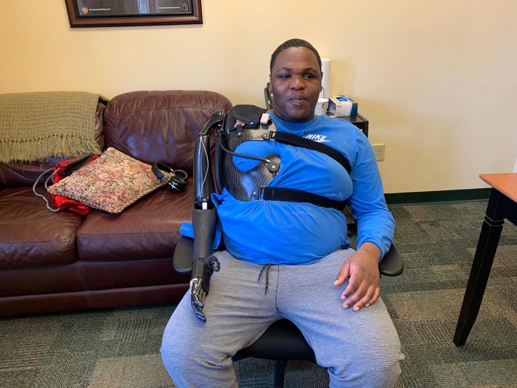 myHandspring's tweet photo. Brian is wearing a @CollegeParkInd axis shoulder joint, an @OttobockUS_CA  Dynamic elbow OB electric wrist rotator&amp; OB BeBionic Hand. He controls elbow wrist hand w/ a linear transducer and switches modes with a chin controlled bump switch Erik Tompkins, C&amp;P, BOCO lead clinician https://t.co/KNwLX4hFTN