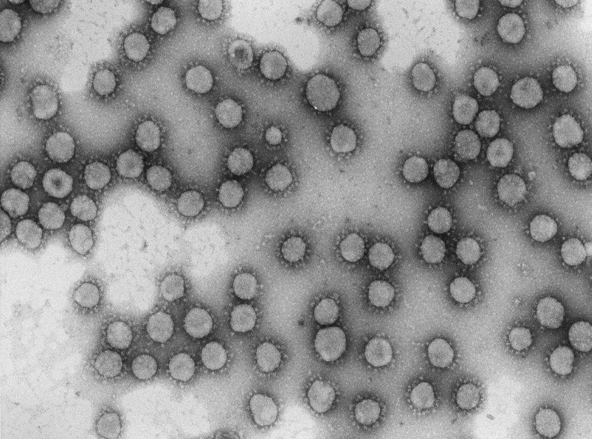 CSIC's tweet photo. Investigadores del CSIC demuestran que un fármaco contra el cáncer logra frenar un #coronavirus humano

Un equipo del @CNB_CSIC ha demostrado ‘in vitro’ que el fármaco aplidin (plitidepsina) bloquea la multiplicación del coronavirus humano HCoV-229E

➡️https://t.co/YalyJHB7jz https://t.co/a9vNKCVczB