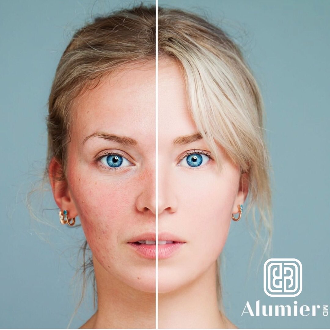 BeautyBoxPang's tweet photo. Struggling with rosacea? The Beauty Box can recommend Alumier MD treatments and products to have you feeling like your most confident self ✨ https://t.co/x1y1cbpvKY