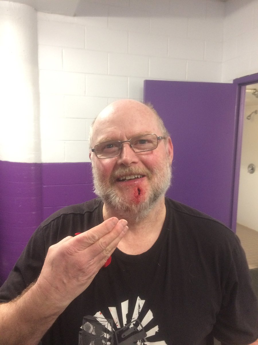 FlyingTuques's tweet photo. Tough playoff opener for the Tuques tonight as they fall 3-1 to the Flying Zambonis. Murray McClure literally took one for the team tonight. Hopefully the stitches are out when the playoff resume after a safety break https://t.co/ybgvB53lQX