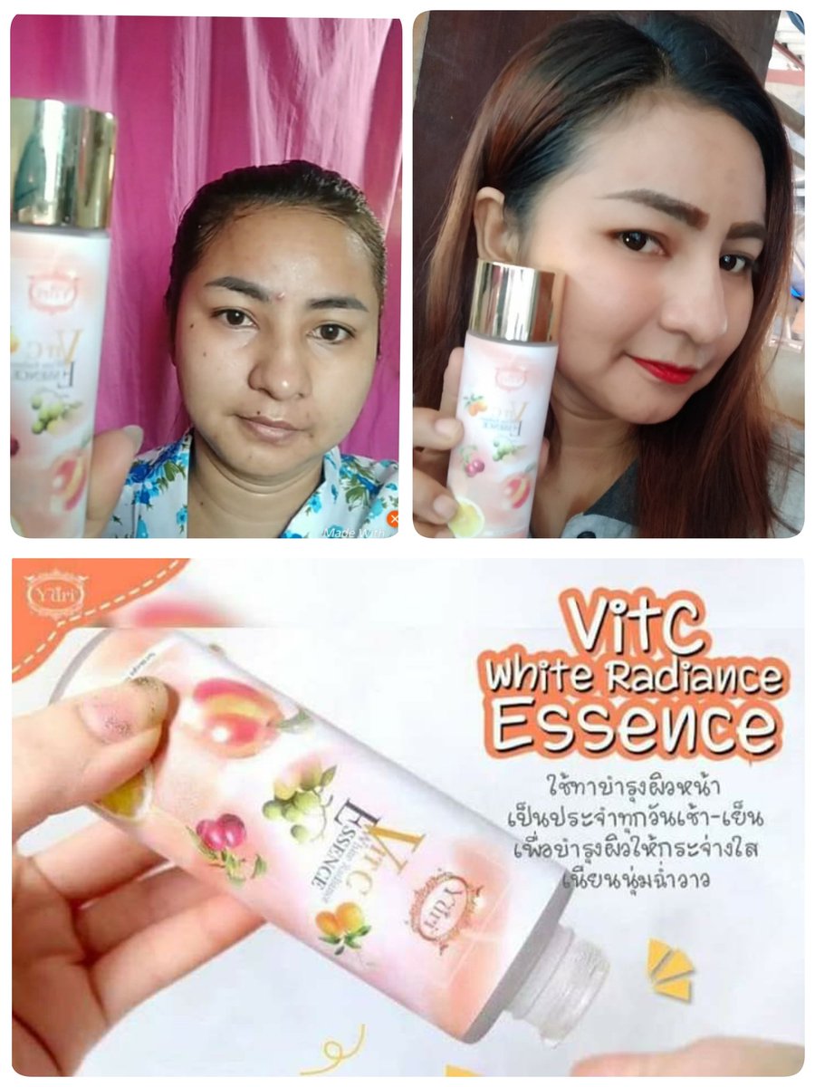 0861705906b's tweet photo. หน้าใส ไกลสิว ริ้วรอยจางลง 💥
.
#น้ำตบวิตซี 🍊 ปลุกผิวให้พร้อมรับการ��ำรุงในขั้นต่อไป ให้สกินแคร์ที่ใช้เข้าสู่ผิวได้ดียิ่งขึ้น 
.
ยิ่งใช้ #หน้ากระจ่างใส #รูขุมขนกระชับ  #สิวหายไร้รอยดำ #ฝ้าจางลง จนเห็นได้ชัด
.
1 ขวด 300.- ส่งฟรี!! https://t.co/zD6ms8HvwB