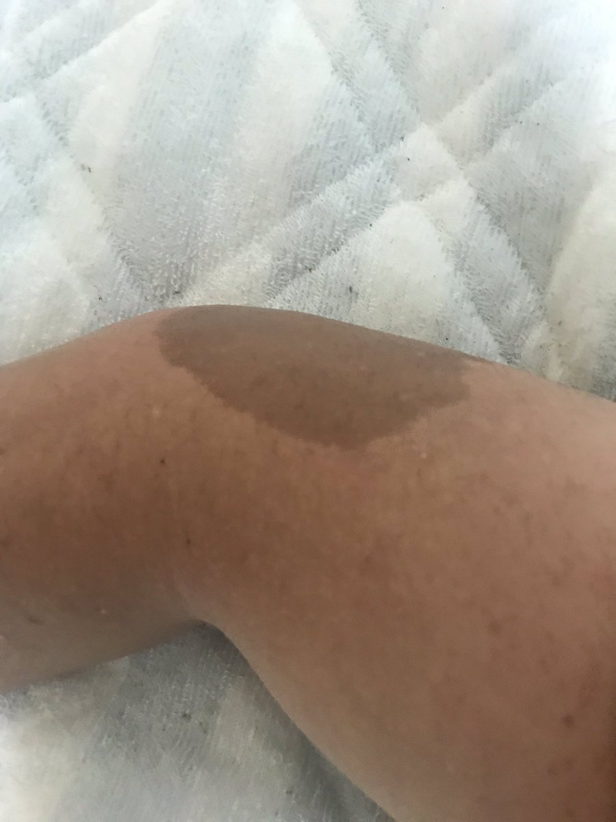 アキミヤ涼夜6 23 8 23個展 京都 Ff外から失礼します 前世の恋人がつけた痣 キスの後だとよりエモいですね 改めてキスする場所の意味を見返したら 前世の恋人との関係性が妄想出来て幸せになりましたありがとうございます