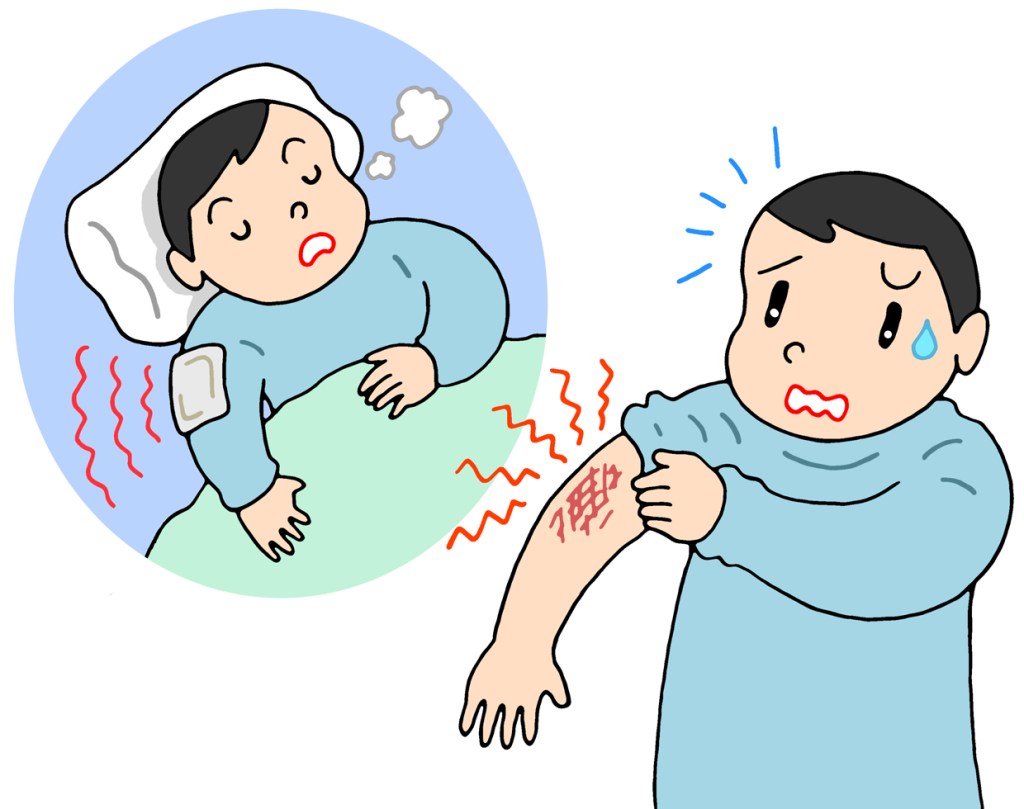 T Koni Di Twitter 怪我のイラスト 低温熱傷 炎症 低温やけど 熱傷 火傷 皮膚組織の破壊 T Co Aeko9nt476 T Koni Di Twitter 怪我のイラスト 低温熱傷 炎症 低温やけど 熱傷 火傷 皮膚組織の破壊 T Co Aeko9nt476