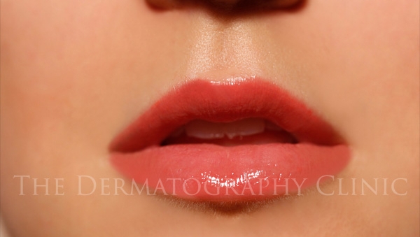 Always exceeding my own expectations? 😜🧞‍♀️

Fully healed results✔️
No filters✔️
Low maintenance✔️
Waterproof✔️
Kissproof✔️
Doesn't look like a tattoo✔️
No downtime✔️
Aftercare included✔️
Personal service included✔️
Happy customer included✔️

#liptattoo