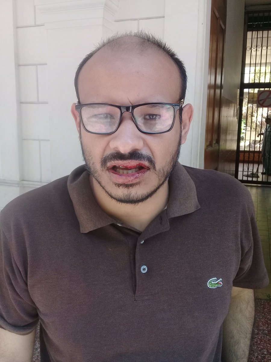 CarlosJRojas13's tweet photo. Acabo de ser golpeado a punto de batazos por colectivos armados frente al metro de Parque Carabobo cuando me disponía a exigir el cierre preventivondel metro de Caracas por ser foco de infección y nido para propagación del corona virus. Estoy actualmente en la Cruz Roja. https://t.co/EtsBc07hhq