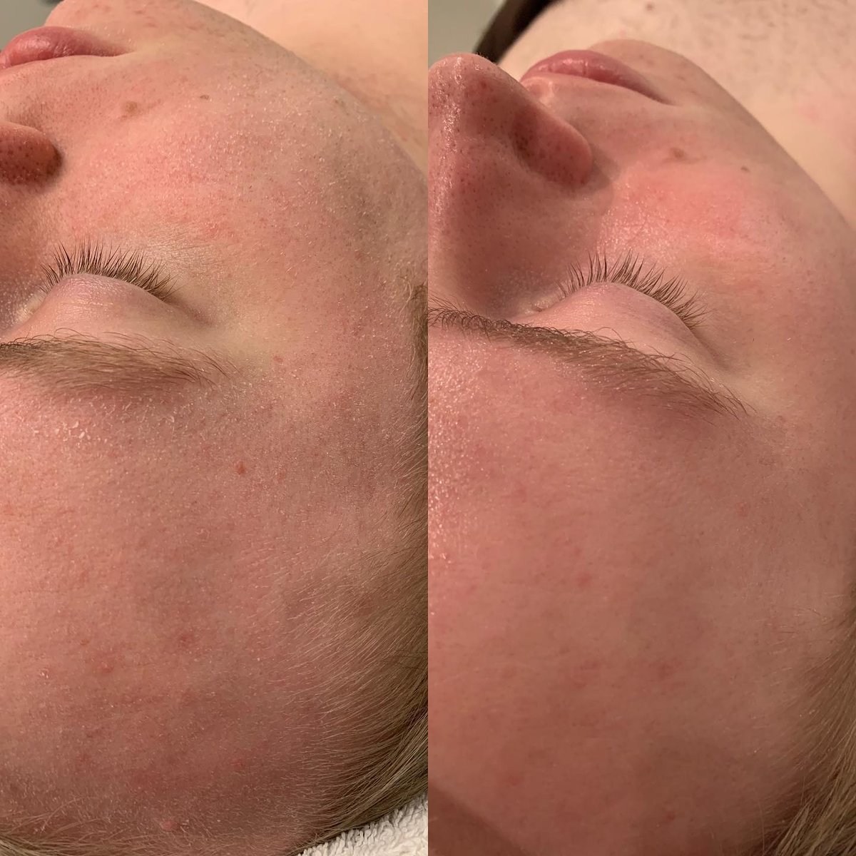 Dermasweep tweet media