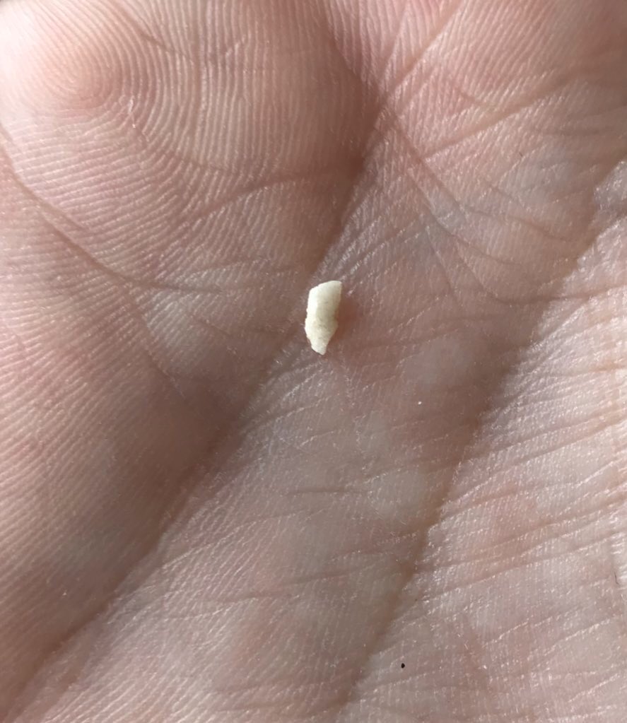 JordonProfit's tweet photo. I have the worst luck with @TimHortons... found this while eating my wrap 🤮 wasn’t expecting to bite down and have this in my food... not sure what the object is.. looks like a piece of tooth 😯but they gave me a gift card so everything alright.. right 😬🙄 https://t.co/3Me84EJJXM