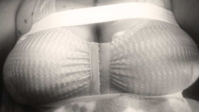 Holy hell!!!! Just realized yesterday was my boobs 6th birthday!!!! Posting 2 pics, 1 from day of surgery