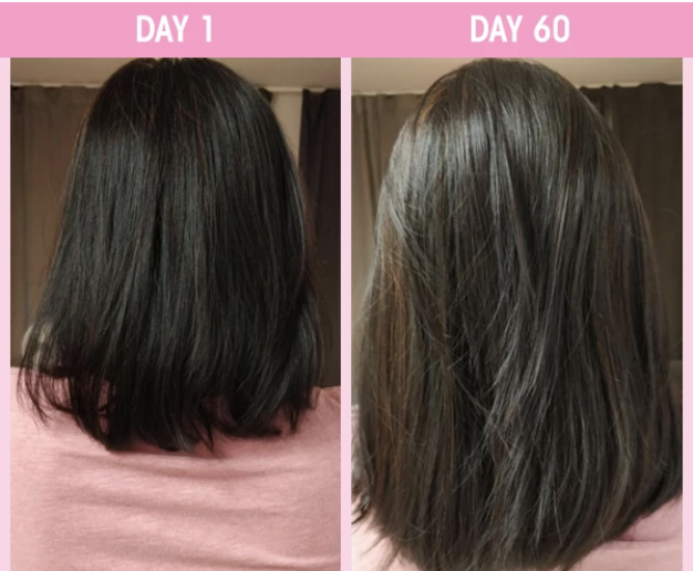 STTROPICA's tweet photo. Swipe to see AMAZING hair growth results! 😍
#customerreview #realcustomerresults #hairgrowth #60dayhairchallenge #hairgrowthvitamins #gorgeoushair #hairgoals #longhairdontcare #productsthatwork #productsyoucantrust #sttropica #sttropicaproducts https://t.co/o3OKlAeqOD