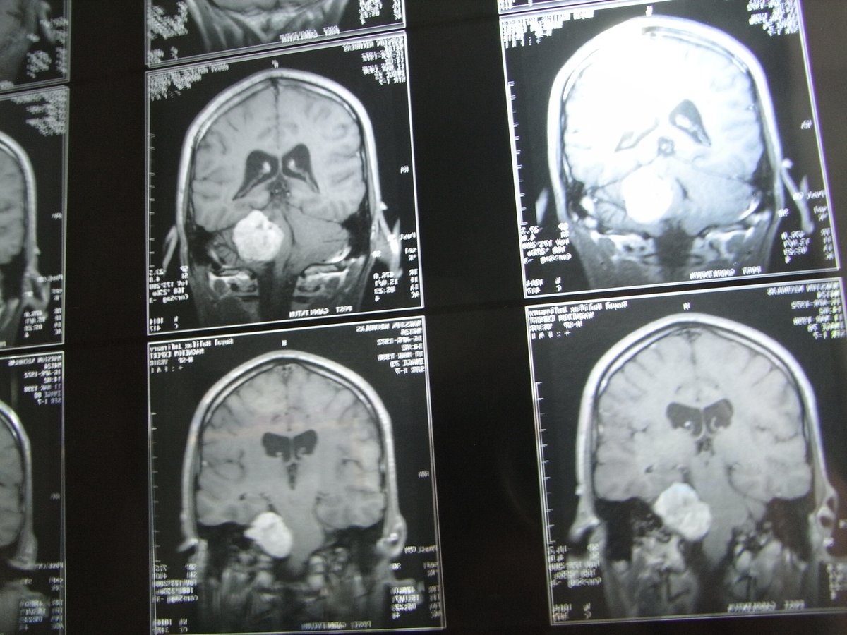BahaNick16's tweet image. #betterviews #PlaceFell 😍 1st Post tumour mountain @BANAUK